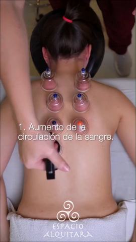 Curso de Ventosaterapia - Nivel 1