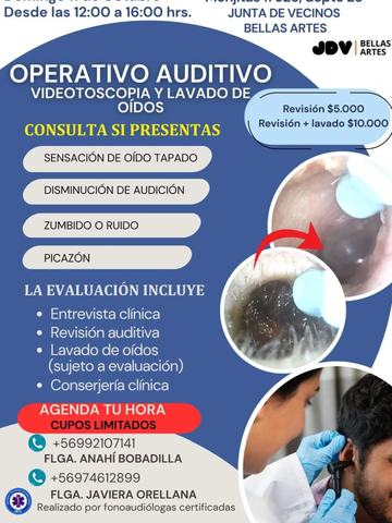 Operativo Auditivo JDV Bellas Artes